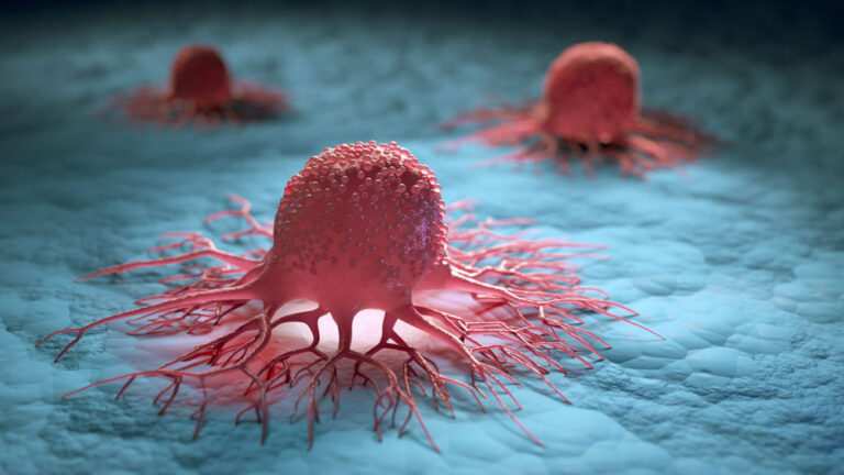 Rising Cancer Cases: The Unfolding Health Crisis in Modern Lifestyles