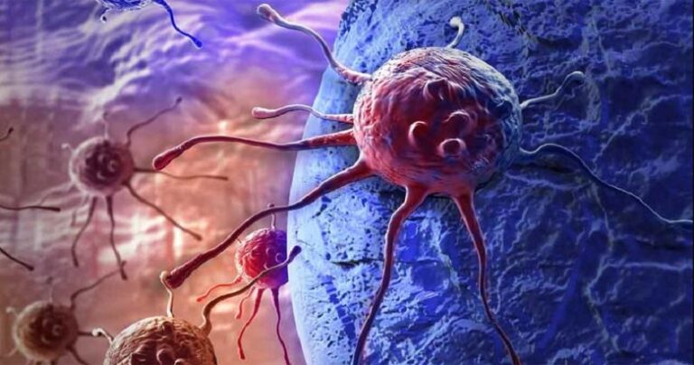 Revolutionary Breakthrough in Breast Cancer Treatment: Supramolecular Hydrogel Therapy